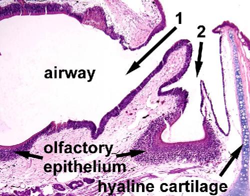 Chapter 5: Figure 2. Chambers of the external nares.