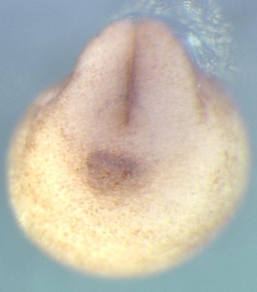 Xenopus aldob / aldolase B, fructose-bisphosphate gene expression in stage 19 embryo. Clone TTpA001g04