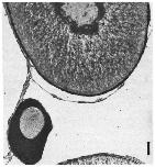 Expression Image